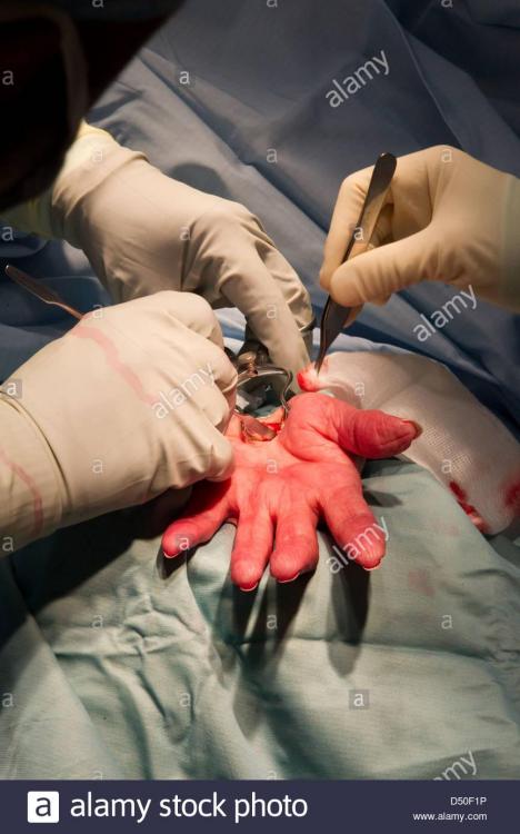 hospital-hand-operation-surgery-nhs-admission-doctor-surgeon-admission-D50F1P.jpg